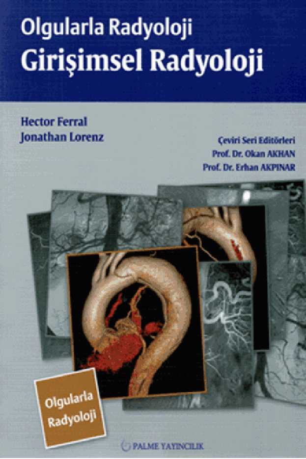 OLGULARLA RADYOLOJİ GİRİŞİMSEL RADYOLOJİ (PALME)