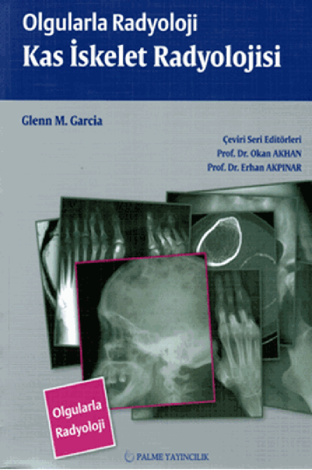 OLGULARLA RADYOLOJİ KAS İSKELET RADYOLOJİ (PALME)