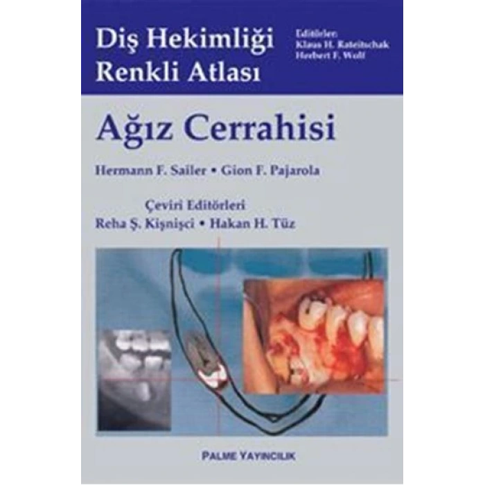 AĞIZ CERRAHİSİ -PALME