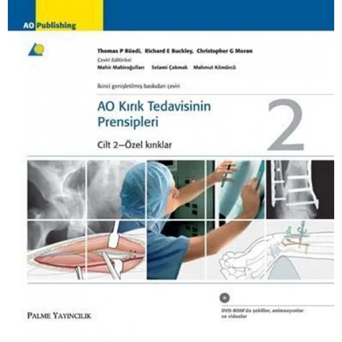 AO KIRIK TEDAVİSİNİN PRENSİPLERİ 1-2 - PALME