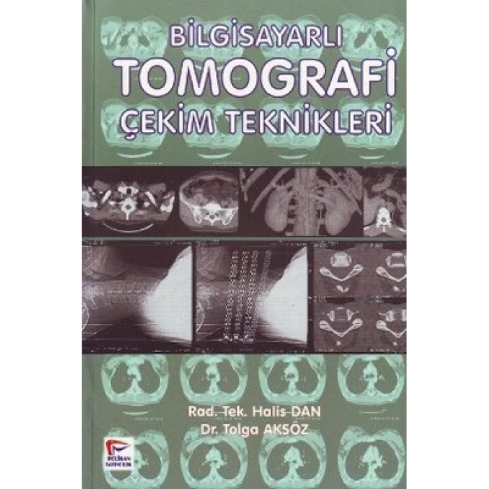 Bilgisayarlı Tomografi Çekim Teknikleri