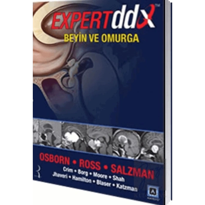 Expert DDX: Beyin ve Omurga