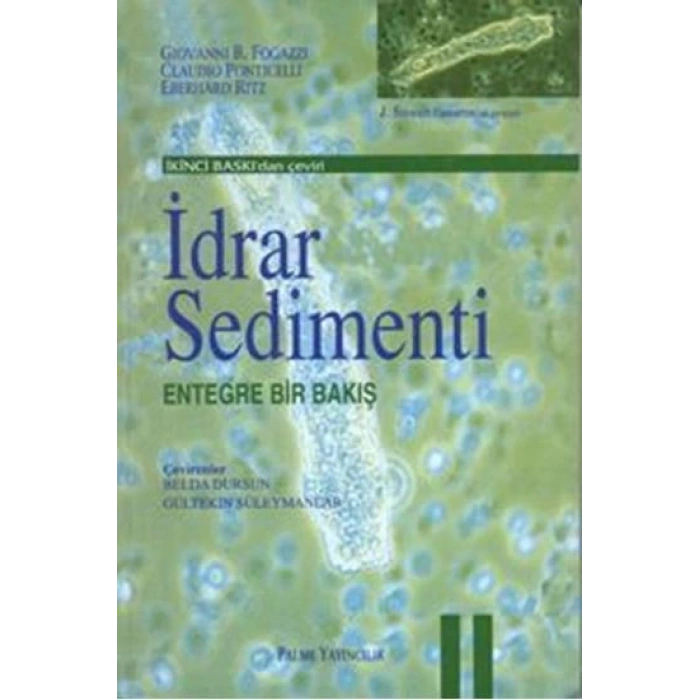 İDRAR SEDİMENTİ -PALME