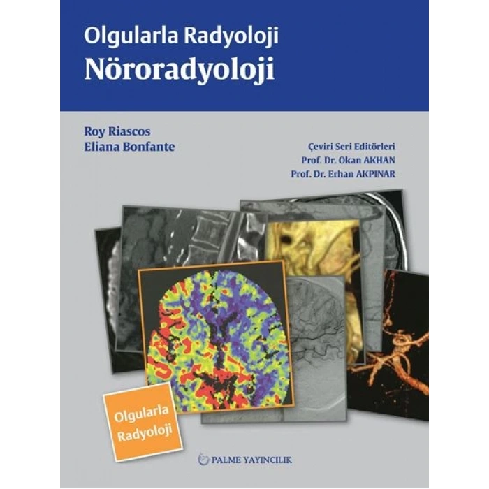 OLGULARLA RADYOLOJİ NÖRORADYOLOJİ (PALME)