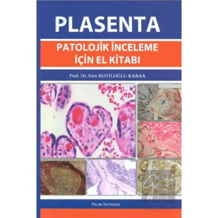 Plasenta Patolojik İnceleme İçin El Kitabı