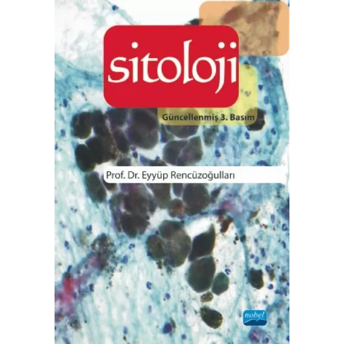 Sitoloji