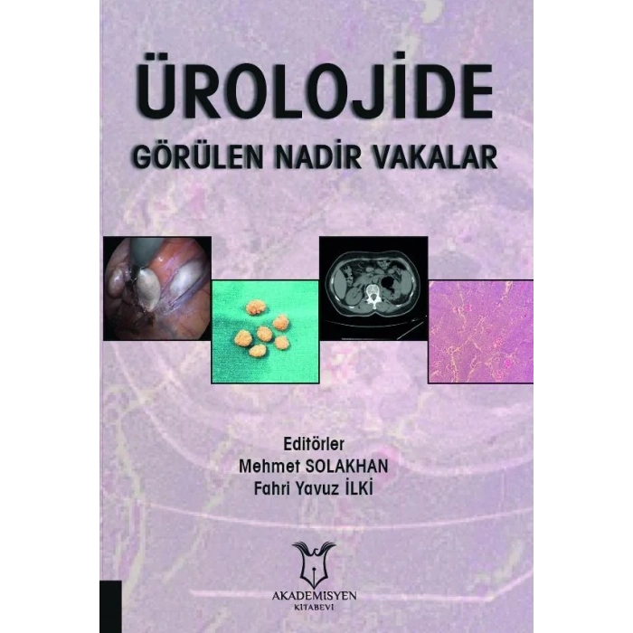 Ürolojide Görülen Nadir Vakalar