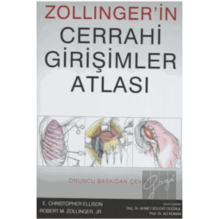 Zollingerin Cerrahi Girişimler Atlası