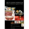 İMPLANT DESTEKLİ OVERDENTURE KLİNİK VE - PALME YAY