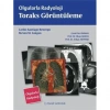 OLGULARLA RADYOLOJİ TORAKS GÖRÜNTÜLEME (PALME)
