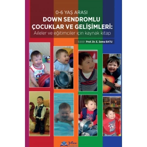 Down Sendromlu Çocuklar ve Gelişimleri