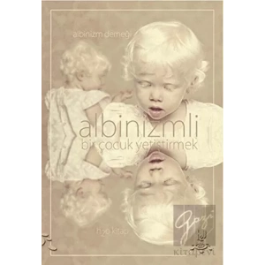 Albinizmli Bir Çocuk Yetiştirmek