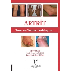 ARTRİT Tanı ve Tedavi Yaklaşımı