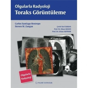 OLGULARLA RADYOLOJİ TORAKS GÖRÜNTÜLEME (PALME)