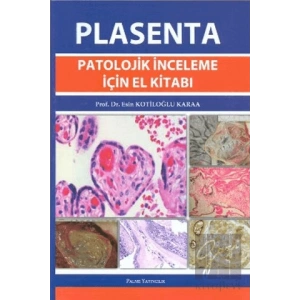 Plasenta Patolojik İnceleme İçin El Kitabı
