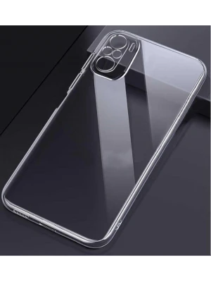 Xiaomi Redmi Note 10S- Redmi Note 10 4G Tıpalı Kamera Korumalı Şeffaf Silikon Kılıf