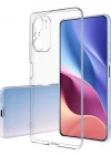 Xiaomi Redmi Note 10S- Redmi Note 10 4G Tıpalı Kamera Korumalı Şeffaf Silikon Kılıf