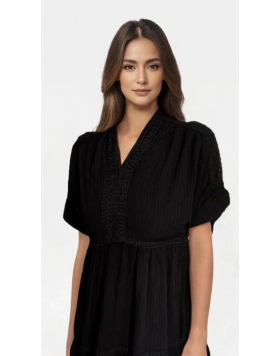 YARASA KOL DANTEL DETAYLI SİYAH ELBİSE