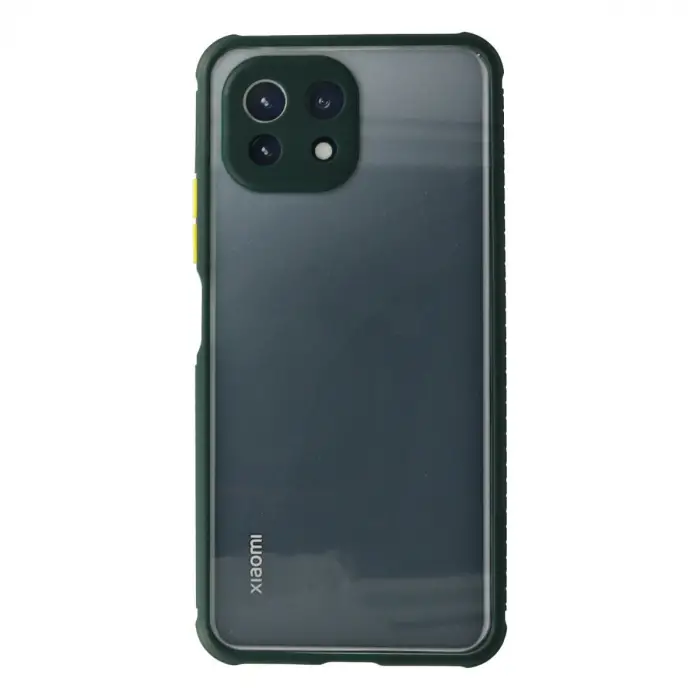 Xiaomi Mi 11 Lite Kılıf Miami Şeffaf Silikon - Koyu Yeşil