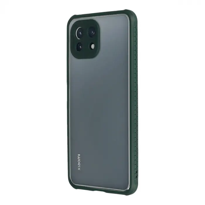 Xiaomi Mi 11 Lite Kılıf Miami Şeffaf Silikon - Koyu Yeşil