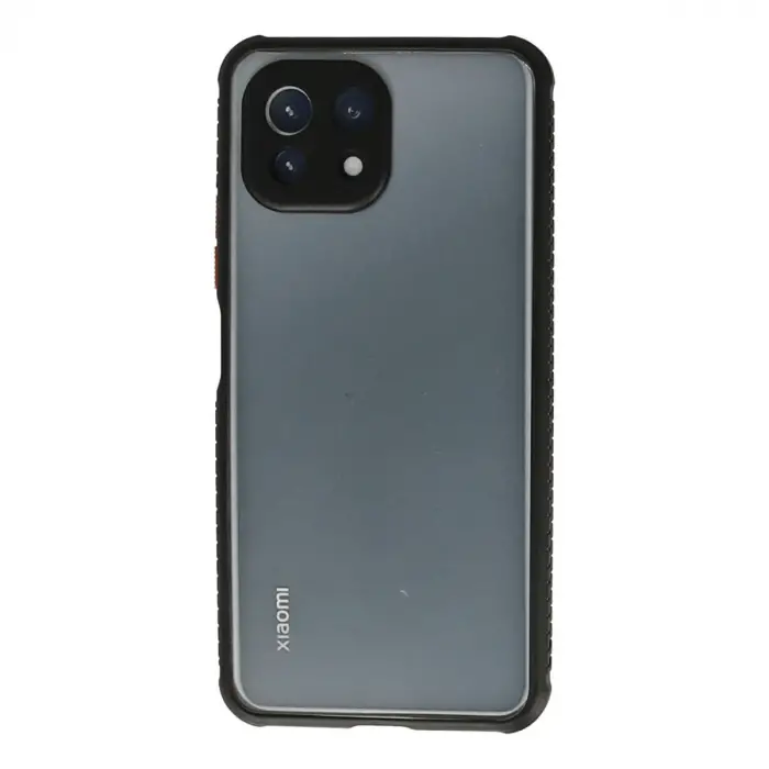 Xiaomi Mi 11 Lite Kılıf Miami Şeffaf Silikon - Siyah