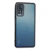 Xiaomi Redmi Note 11 Pro Kılıf Razer Lensli Silikon - Siyah