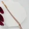 Xupıng Bileklik