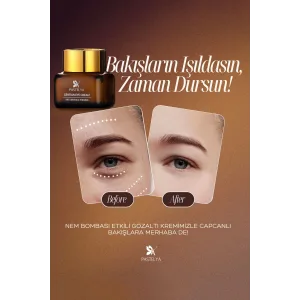 Yaşlanma Karşıtı Göz Kremi – Kaz Ayağı Ve Bakım