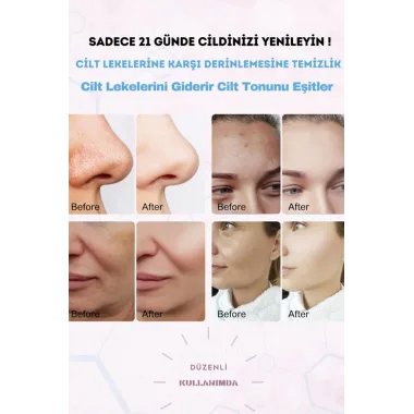 Leke Karşıtı Kojik Asit Zerdeçal Yüz Temizleme Pedi 40 Adet