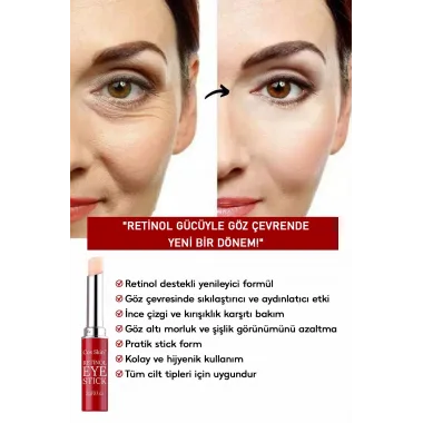 Retinol Göz Çevresi Bakım Stick – Kırışıklık Ve Morluk Karşıtı 3g