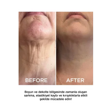 Sıkılaştırıcı Boyun Kremi 50ml | Lifting & Nemlendirici Bakım