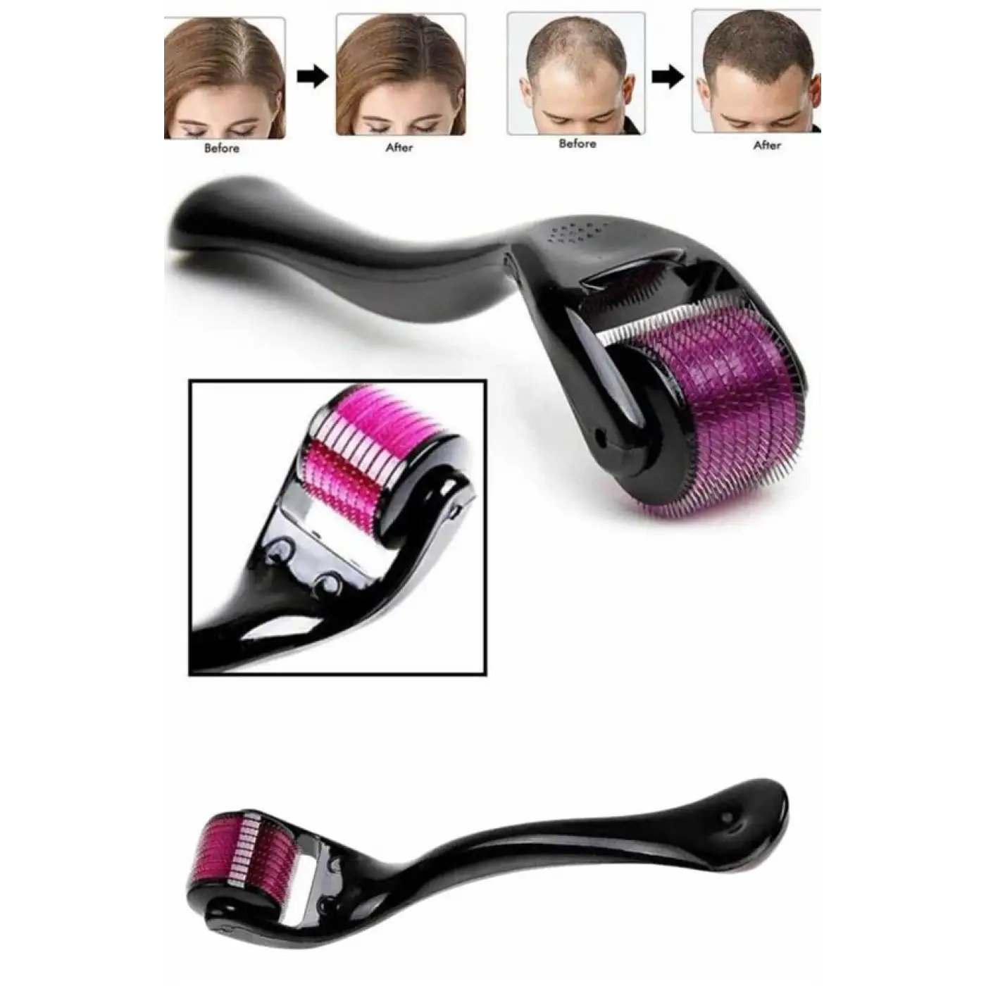 Derma Roller Titanyum Uçlu 540 İğneli 1 Mm Saç Sakal Çıkarma Ve Cilt Bakım Masaj Aleti