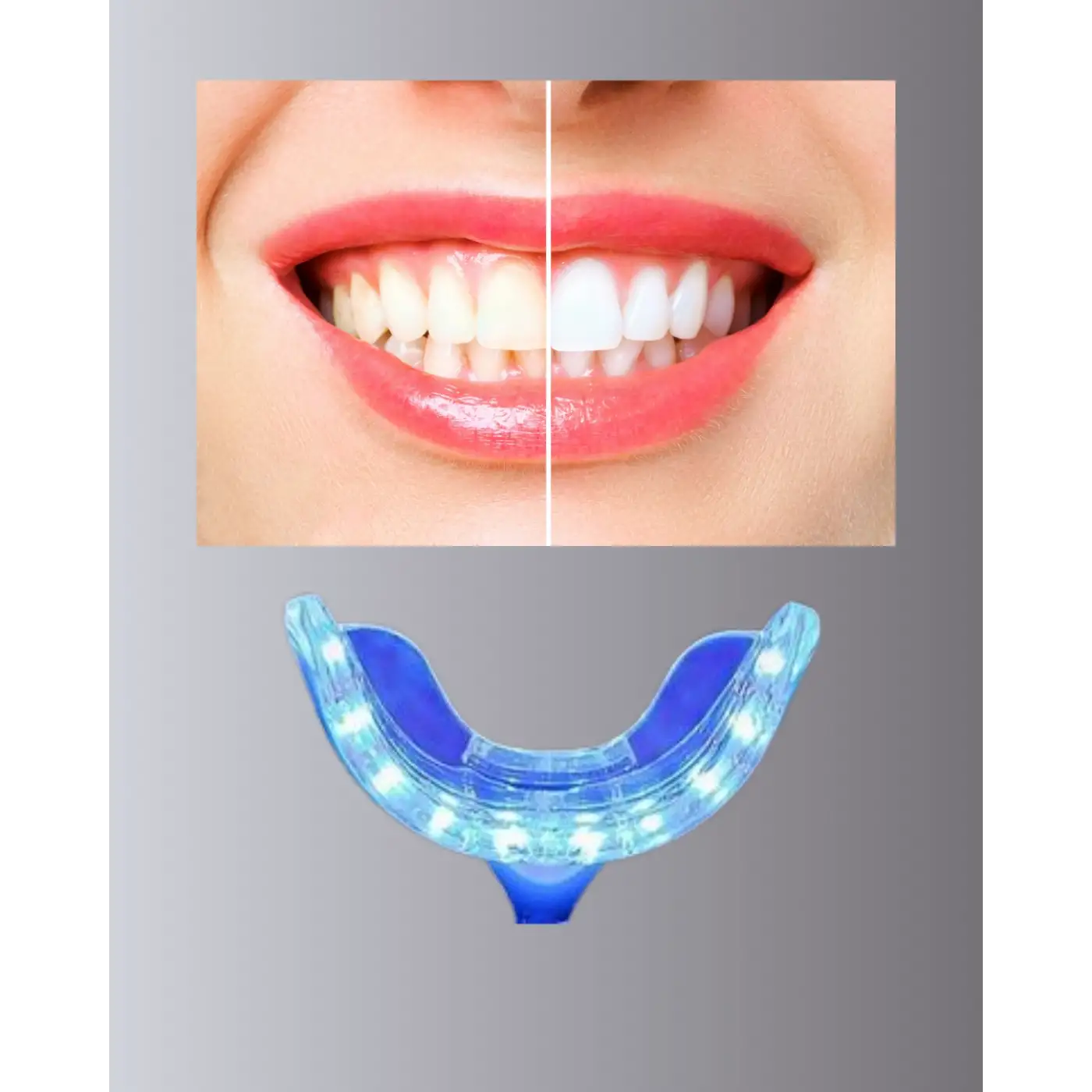 LED Işıklı Profesyonel Diş Beyazlatma Seti