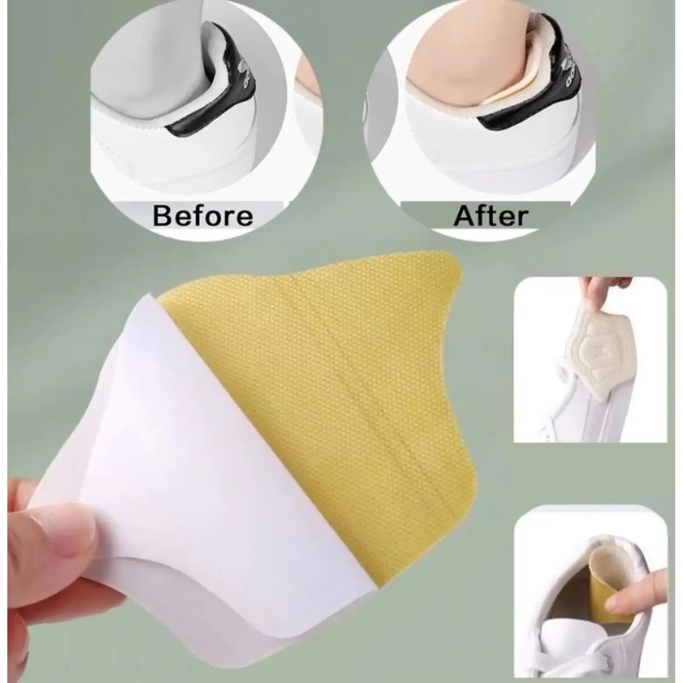 Pratik Taç Şekilli 10 Mm Topuk Daraltma Ve Vurma Önleyici