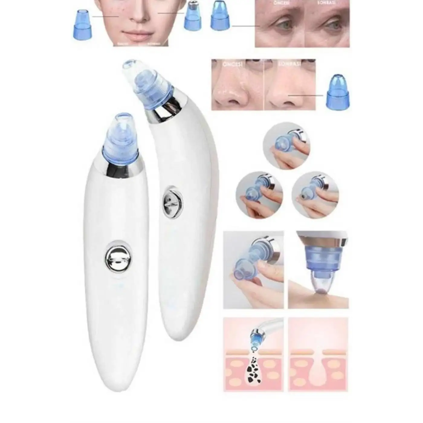 Vakumlu Siyah Nokta Ve Yüz Temizleme Cihazı 4 Başlıklı