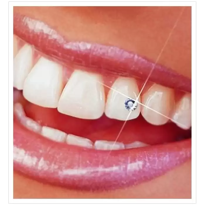 Elit Diş Kristali ve Diş Pırlantası 5 Adet Muhteşem Gülüş Seti