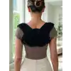 KLAVİKULA KÖPRÜCÜK KEMİĞİ DESTEKLİ