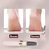 Şarjlı Ayak Törpüsü - Pedikür ve Ayak Bakım Aleti