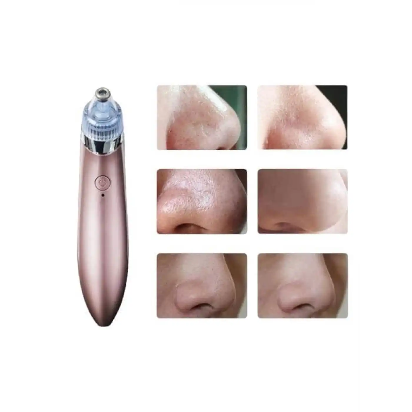 SİYAH NOKTA CİHAZI