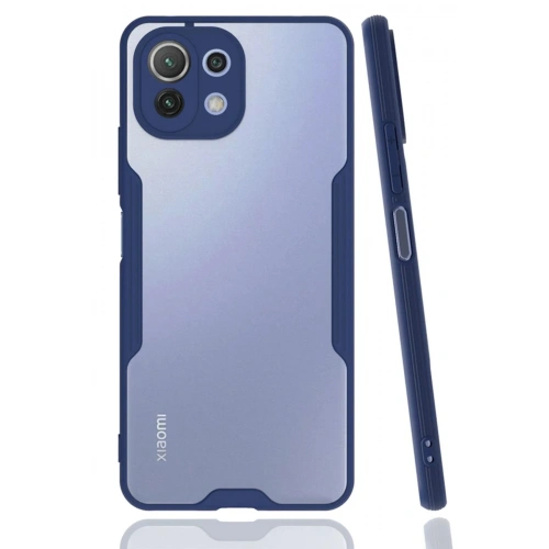 Mey İthalat®   Mİ 11 Lite Kılıf Platin Silikon - Lacivert