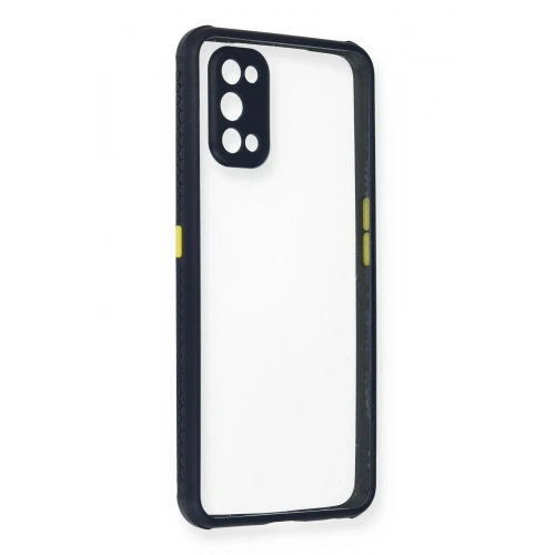 Mey İthalat®  Realme 7 Pro Kılıf Miami Şeffaf Silikon - Lacivert