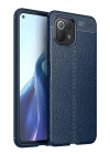 Mey İthalat®   Mİ 11 Lite Kılıf Auto Focus Kapak - Lacivert