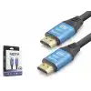 Hdmi 2.0 Kablo 4K Uhd 19+1 Od 8.0 Mm 1.5 M - Siyah Mavi ND4050