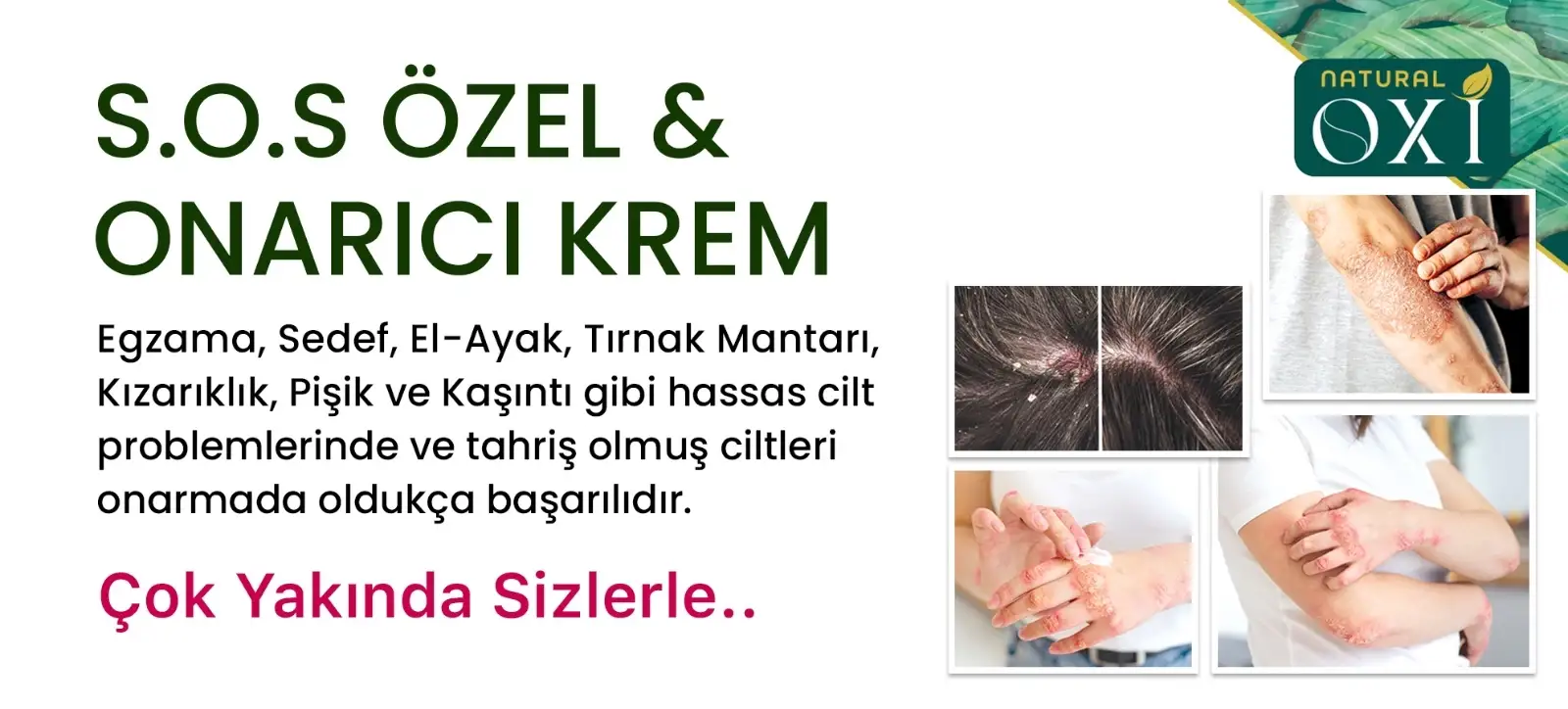 Doğal içerikli acil (s.o.s.) onarıcı krem..