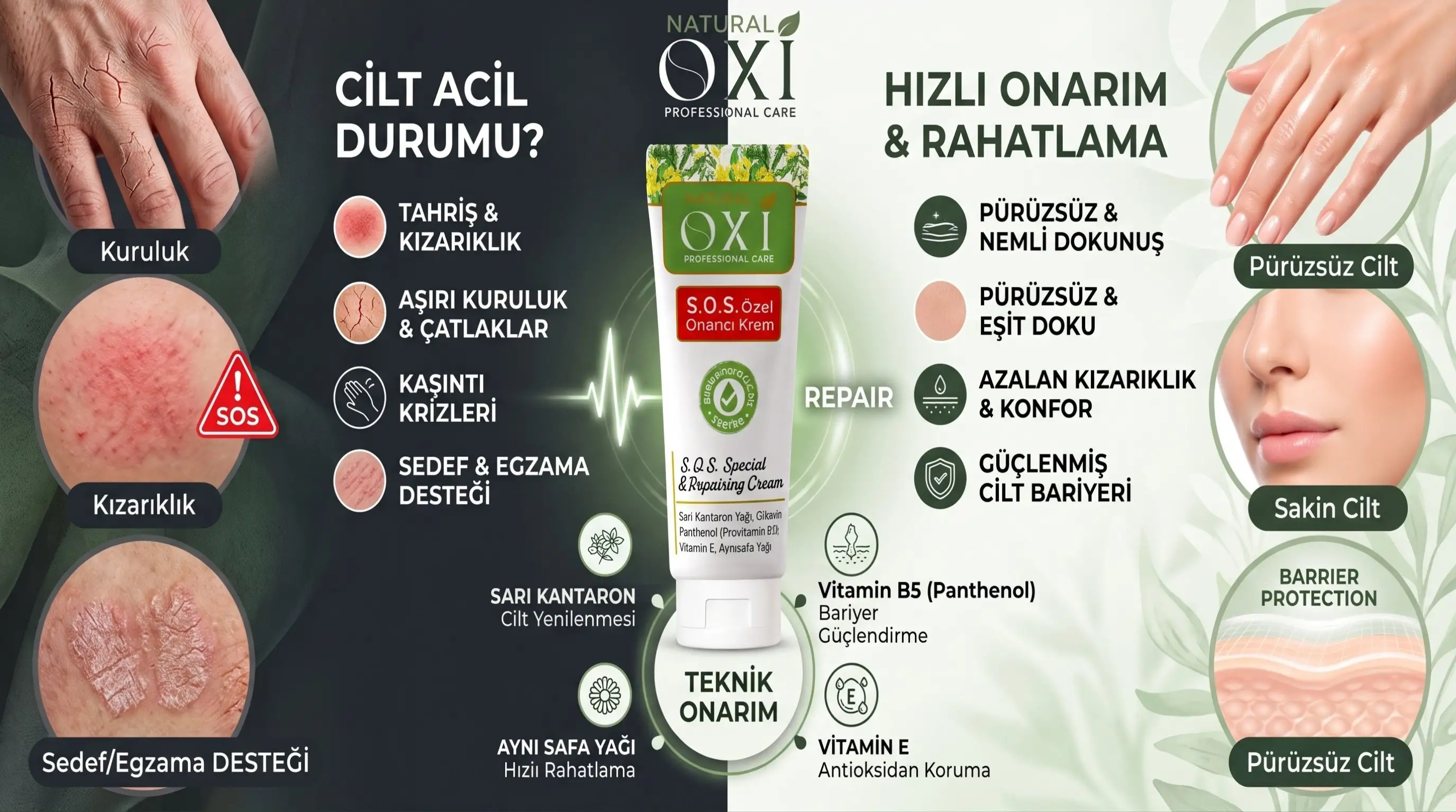 Doğal içerikli acil (s.o.s.) onarıcı krem..