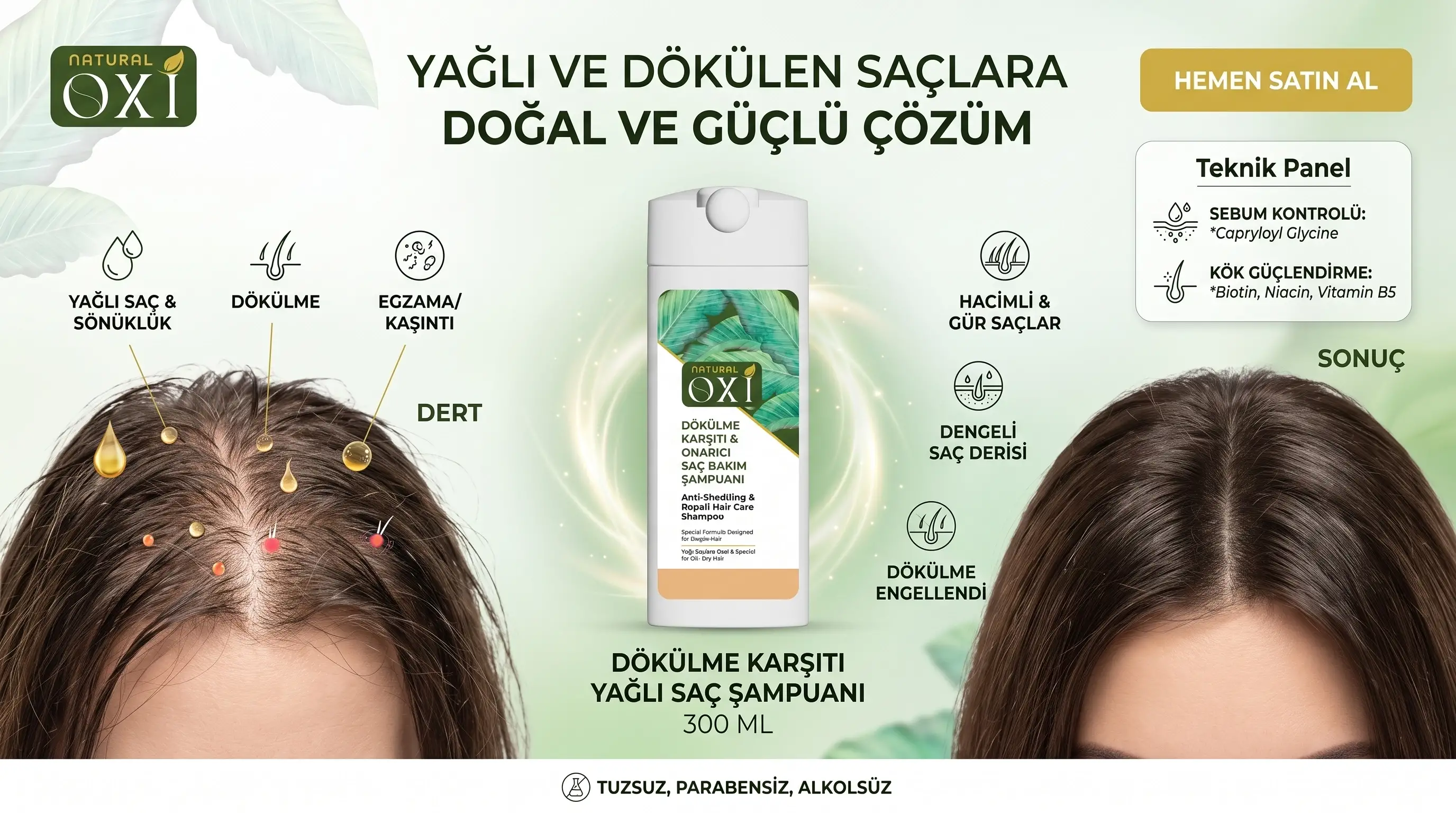 Doğal İçerikli Yağlı Saç Şampuanı