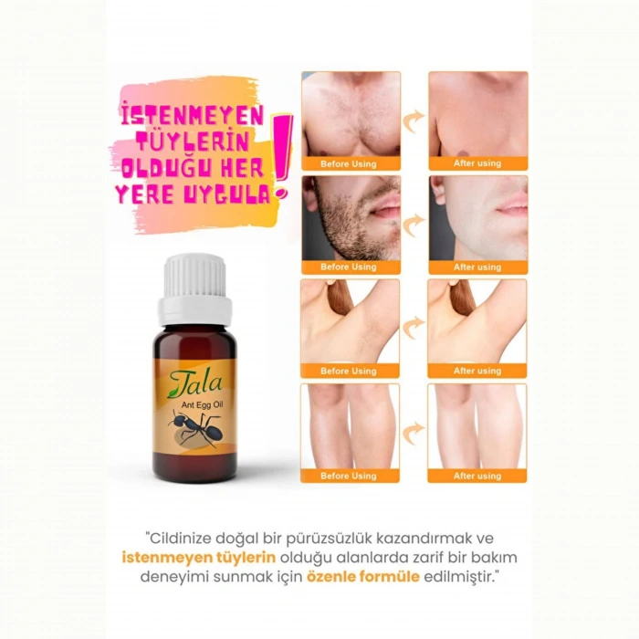 Tala Karınca Yumurtası Yağı Tüy Azaltıcı Tüy İnceltici Tüy Dökücü 20 Ml