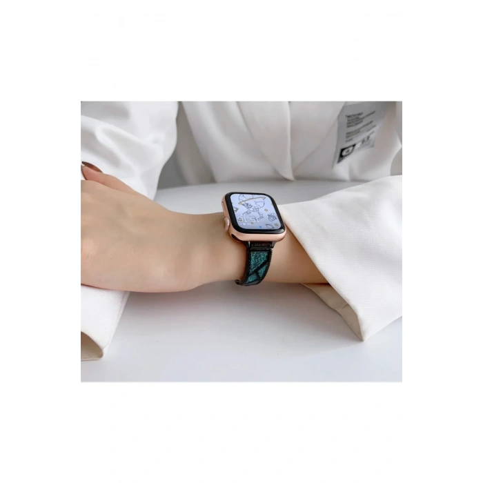 Apple Watch Uyumlu Fashion Loop Kordon