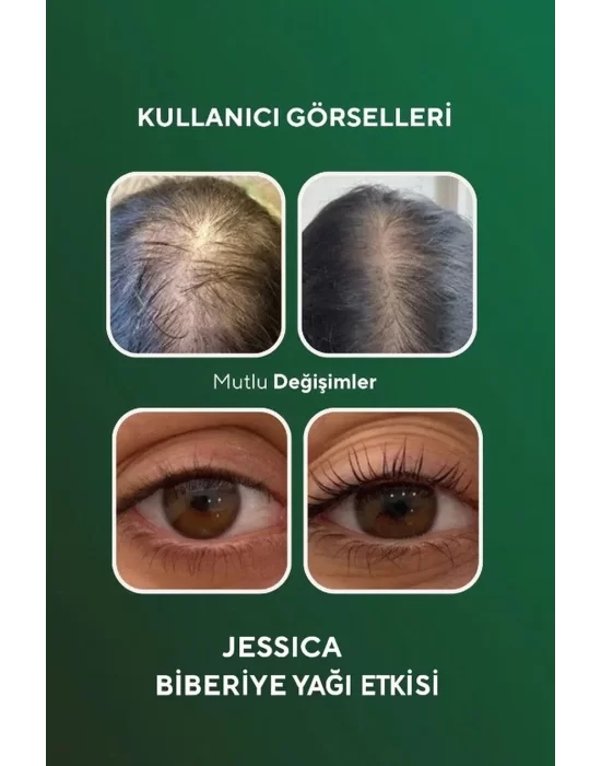 Biberiye Yağı Complexi Yıpranmış Saçlar İçin Hızlı Saç Uzatan Biotinli Saç Bakım Serumu