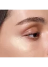 Gözenek, Sivilce Ve Siyah Nokta Karşıtı Niacinamide Serum 30 Ml